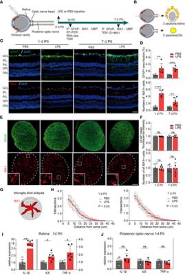 Optic nerve head: A gatekeeper for vitreous infectious insults?